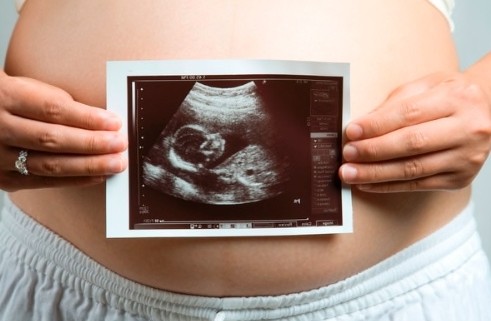 4D 입체 초음파 검사와 일반 초음파 차이를 설명하는 예비 부모 안내 이미지