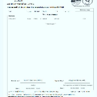2021년 대리모 시험관 배아 이식 후 1차 임신 혈액 테스트 hcg 수치 400 이상으로 아주 좋은 수치가 나왔습니다. 이 경우 2차 검사도 기대됩니다. 수년동안 아기를 기다리던 의뢰인에게 좋은 소식 입니다.