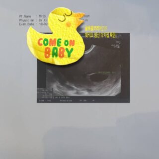 2018년 #대리모 #시험관 #이식 성공 #초음파검사 #아기집 확인 #글로벌코리아ivf 10년차 부부의 #난임극복