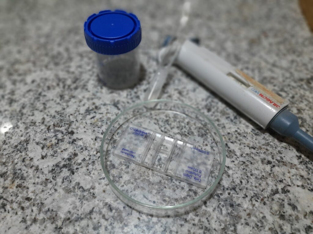 정액 분석 단계 — 정자 수·운동성·형태 검사 과정 (정액 검사)