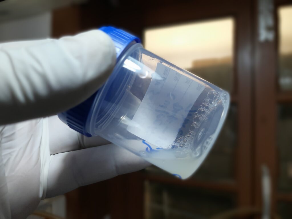 정자 분석 및 현미경 관찰 — 남성 불임 검사